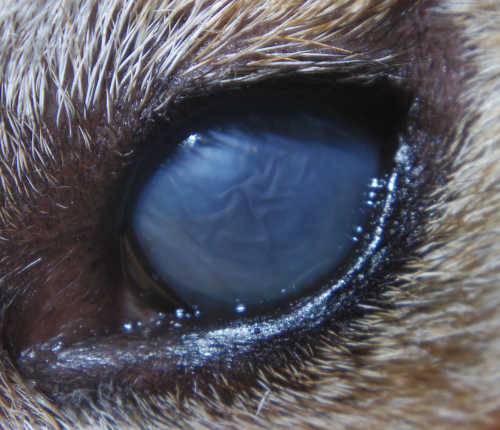 義眼手術