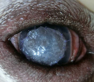 角膜潰瘍　人工膜
