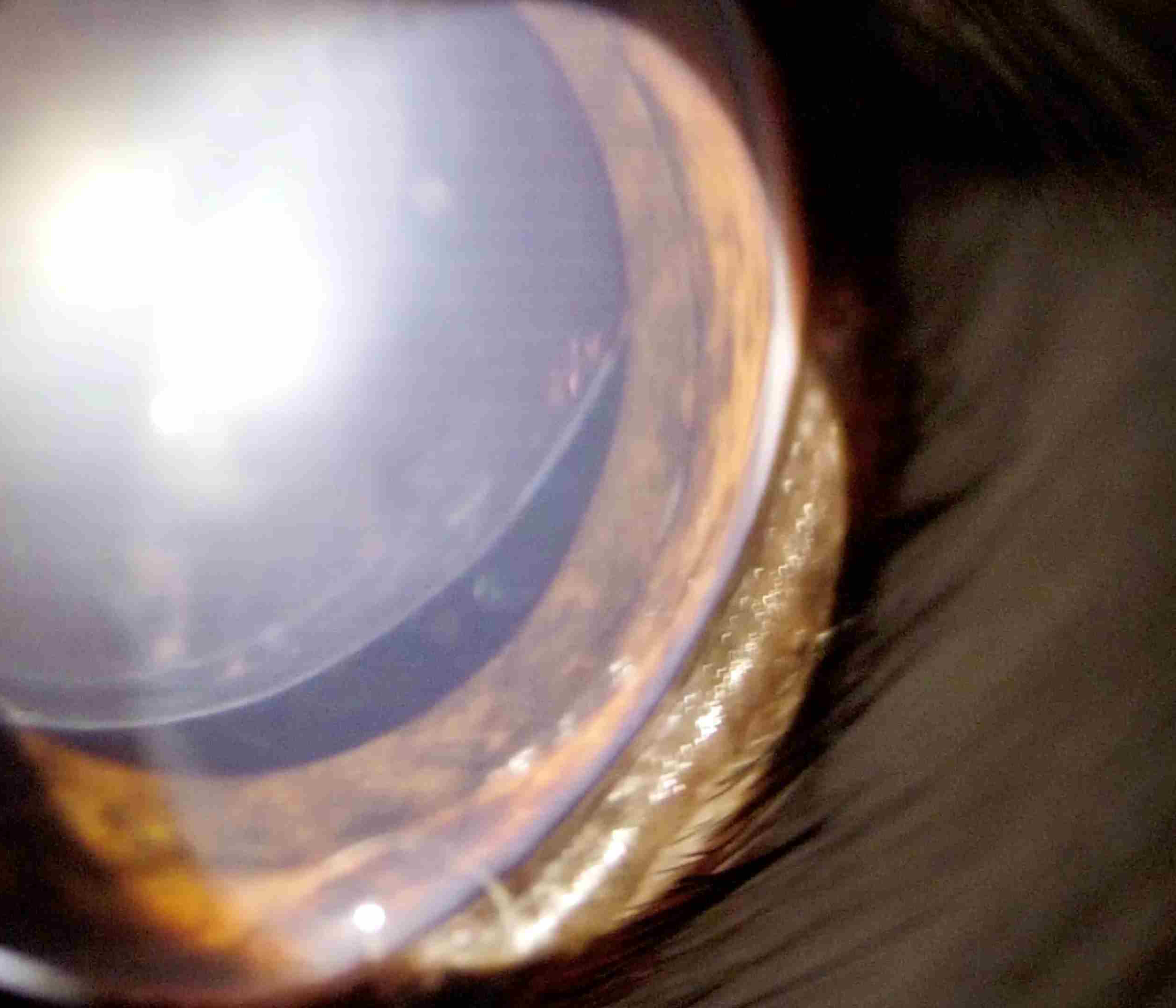 犬　水晶体亜脱臼